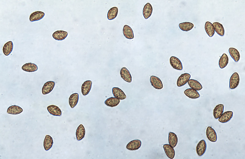 Cortinarius albertii spory